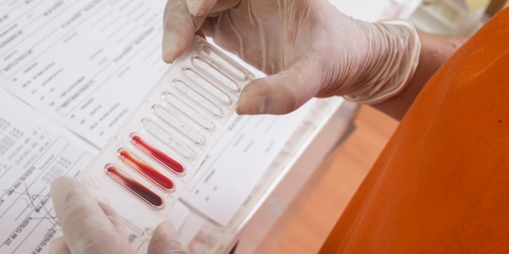 41560343_m_normal_none